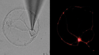 Image: Photomicrograph of nerve cell during an electrical recording (left), fluorescently labeled nerve cell (right), (Photo courtesy of Sanford-Burnham Medical Research Institute).